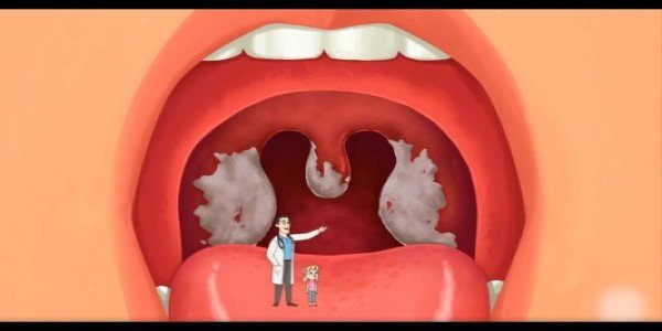 Top Ten News Items on Health, 14th July 2023