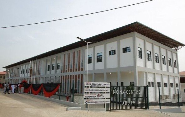 Keeping Noma Under Control: Why Nigeria Must Not Lose Momentum